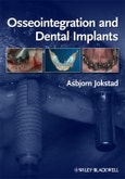 Osseointegration and Dental Implants. Edition No. 1- Product Image