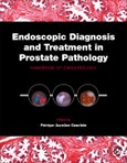 Endoscopic Diagnosis and Treatment in Prostate Pathology. Handbook of Endourology- Product Image