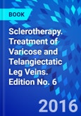 Sclerotherapy. Treatment of Varicose and Telangiectatic Leg Veins. Edition No. 6- Product Image