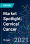 Market Spotlight: Cervical Cancer - Product Thumbnail Image