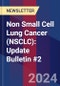 Non Small Cell Lung Cancer (NSCLC): Update Bulletin #2 - Product Image