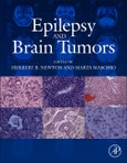 Epilepsy and Brain Tumors- Product Image