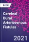 Cerebral Dural Arteriovenous Fistulas - Product Image