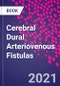 Cerebral Dural Arteriovenous Fistulas - Product Thumbnail Image