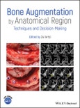 Bone Augmentation by Anatomical Region. Techniques and Decision-Making. Edition No. 1- Product Image