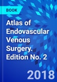 Atlas of Endovascular Venous Surgery. Edition No. 2- Product Image