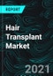 Hair Transplant Market, Global Forecast by Methods, Products, Therapy, Gender, Service Provider, Region, Company Analysis - Product Thumbnail Image