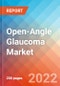 Open-Angle Glaucoma - Market Insight, Epidemiology and Market Forecast -2032 - Product Image