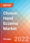 Chronic Hand Eczema (CHE) - Market Insight, Epidemiology and Market Forecast -2032 - Product Thumbnail Image