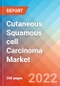 Cutaneous Squamous cell Carcinoma (CsCC) - Market Insight, Epidemiology and Market Forecast -2032 - Product Image