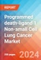 Programmed death-ligand 1 (PD-L1) Non-small Cell Lung Cancer (NSCLC) - Market Insight, Epidemiology and Market Forecast - 2034 - Product Thumbnail Image