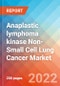Anaplastic lymphoma kinase Non-Small Cell Lung Cancer (ALK-NSCLC) - Market Insight, Epidemiology and Market Forecast -2032 - Product Image