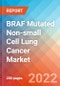 BRAF Mutated Non-small Cell Lung Cancer (NSCLC) - Market Insight, Epidemiology and Market Forecast -2032 - Product Image