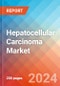 Hepatocellular Carcinoma - Market Insight, Epidemiology and Market Forecast -2032 - Product Thumbnail Image