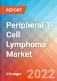 Peripheral T-Cell Lymphoma Market Insight, Epidemiology And Market Forecast - 2032- Product Image