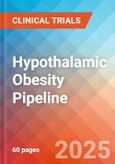 Hypothalamic Obesity (HO) - Pipeline Insight, 2024- Product Image