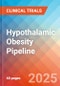 Hypothalamic Obesity (HO) - Pipeline Insight, 2024 - Product Thumbnail Image