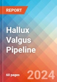 Hallux Valgus - Pipeline Insight, 2020- Product Image
