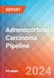 Adrenocortical Carcinoma - Pipeline Insight, 2021 - Product Thumbnail Image