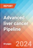Advanced liver cancer - Pipeline Insight, 2020- Product Image