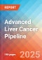 Advanced liver cancer - Pipeline Insight, 2024 - Product Image