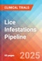 Lice Infestations - Pipeline Insight, 2024 - Product Image