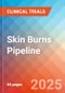 Skin Burns - Pipeline Insight, 2024 - Product Image