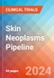 Skin Neoplasms - Pipeline Insight, 2024 - Product Image