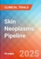 Skin Neoplasms - Pipeline Insight, 2024 - Product Image