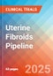 Uterine fibroids - Pipeline Insight, 2024 - Product Thumbnail Image