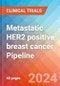 Metastatic HER2 positive breast cancer - Pipeline Insight, 2024 - Product Image