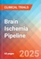 Brain Ischemia - Pipeline Insight, 2024 - Product Thumbnail Image