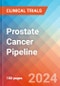Prostate Cancer - Pipeline Insight, 2021 - Product Image