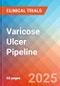 Varicose Ulcer - Pipeline Insight, 2024 - Product Thumbnail Image