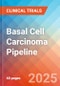 Basal Cell Carcinoma (Basal Cell Epithelioma) - Pipeline Insight, 2024 - Product Image