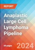 Anaplastic Large Cell Lymphoma - Pipeline Insight, 2024- Product Image