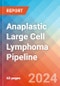 Anaplastic Large Cell Lymphoma - Pipeline Insight, 2022 - Product Image