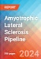 Amyotrophic Lateral Sclerosis - Pipeline Insight, 2021 - Product Image