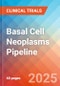 Basal Cell Neoplasms - Pipeline Insight, 2024 - Product Image