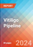 Vitiligo - Pipeline Insight, 2021- Product Image