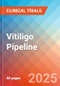 Vitiligo - Pipeline Insight, 2021 - Product Image