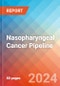 Nasopharyngeal Cancer - Pipeline Insight, 2024 - Product Thumbnail Image