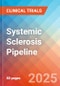 Systemic Sclerosis - Pipeline Insight, 2021 - Product Thumbnail Image