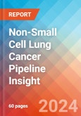Non-Small Cell Lung Cancer (NSCLC) Pipeline Insight, 2024- Product Image