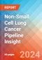 Non-Small Cell Lung Cancer (NSCLC) Pipeline Insight, 2024 - Product Image