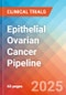 Epithelial Ovarian Cancer - Pipeline Insight, 2024 - Product Thumbnail Image