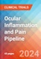 Ocular Inflammation and Pain - Pipeline Insight, 2021 - Product Image
