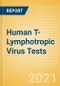 Human T-Lymphotropic Virus (HTLV) Tests (In Vitro Diagnostics) - Global Market Analysis and Forecast Model (COVID-19 Market Impact) - Product Image