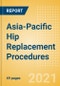 Asia-Pacific Hip Replacement Procedures Outlook to 2025 - Hip Resurfacing Procedures, Partial Hip Replacement Procedures and Others - Product Thumbnail Image