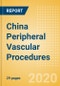 China Peripheral Vascular Procedures Outlook to 2025 - Carotid Artery Angiography Procedures, Carotid Artery Angioplasty Procedures, Carotid Artery Bare Metal Stenting Procedures and Others - Product Thumbnail Image